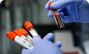 hematologia