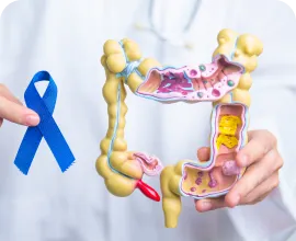 tratamento para câncer colorretal