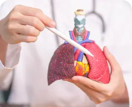 tratamento para câncer de pulmão